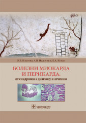 Болезни миокарда и перикарда