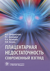 Плацентарная недостаточность