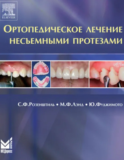 Ортопедическое лечение несъемными протезами