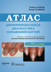 Дифференциальная диагностика поражений ногтей
