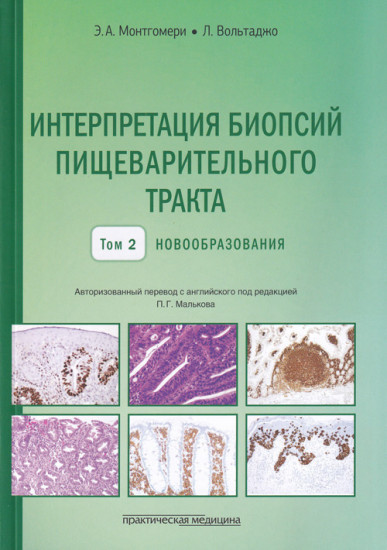 Интерпретация биопсий пищеварительного тракта. Новообразования. Том 2