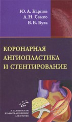 Коронарная ангиопластика и стентирование