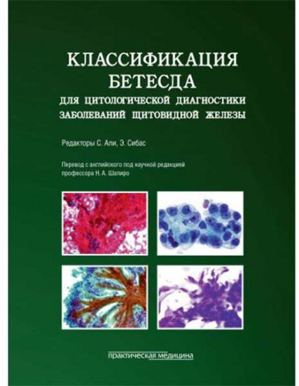 Классификация Бетесда для цитологической диагностики заболеваний щитовидной железы: терминология, критерии и пояснения