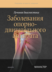 Лучевая диагностика