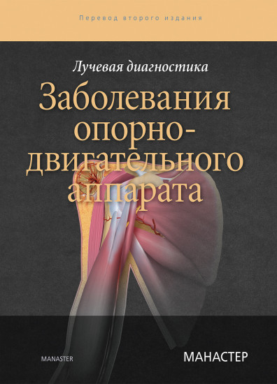 Лучевая диагностика