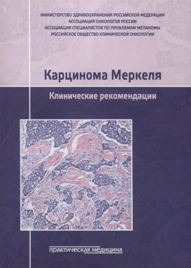 Карцинома Меркеля