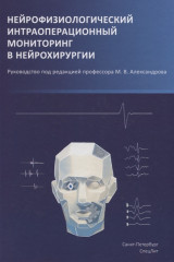 Нейрофизиологический мониторинг