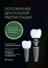 Осложнение дентальной имплантации