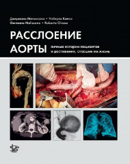 Расслоение аорты