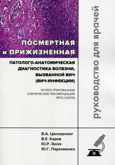 Диагностика болезни, вызванной ВИЧ