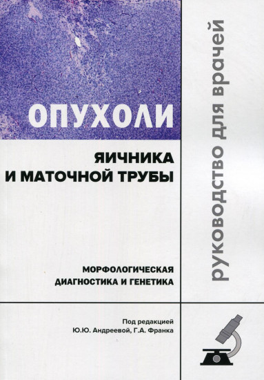 Опухоли яичника и маточной трубы