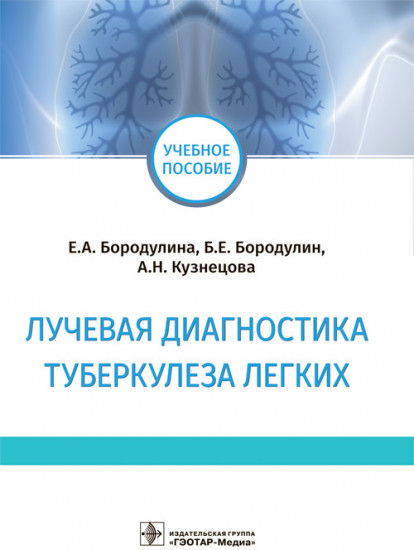 Лучевая диагностика туберкулеза легких