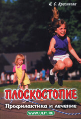 Плоскостопие