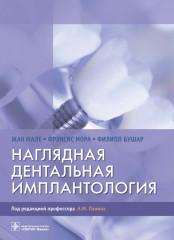 Наглядная дентальная имплантология