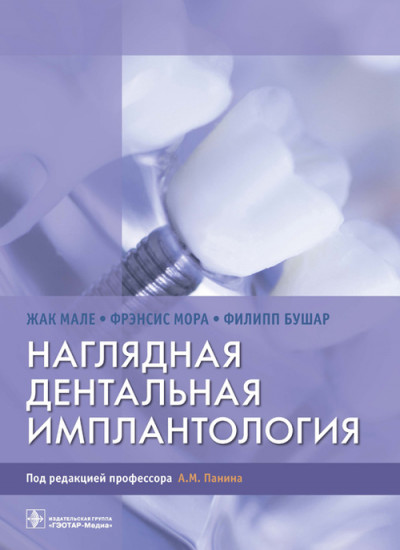 Наглядная дентальная имплантология