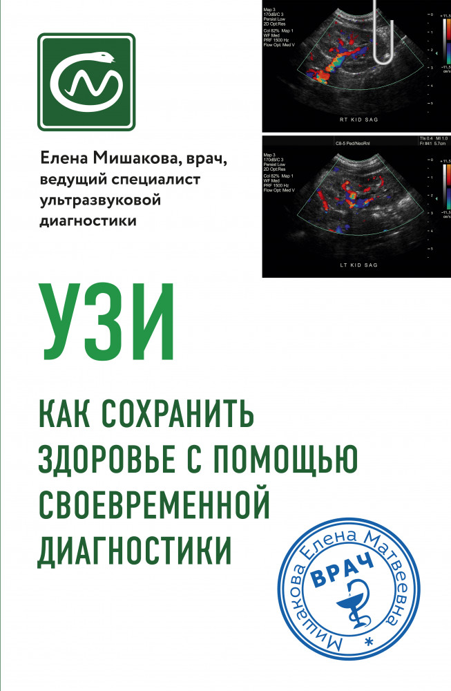 УЗИ. Как сохранить здоровье с помощью своевременной диагностики | Книги-консультанты по вашему здоровью
