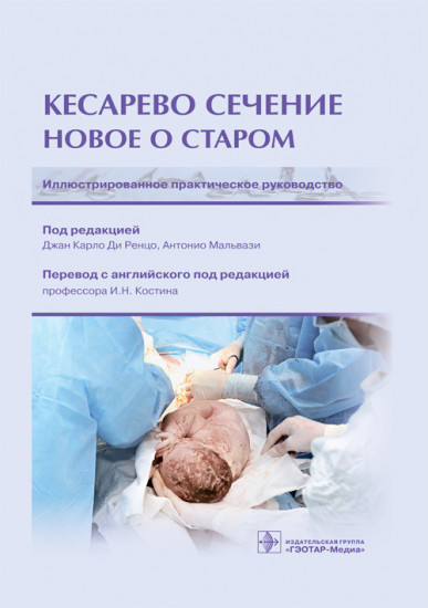 Кесарево сечение. Новое о старом