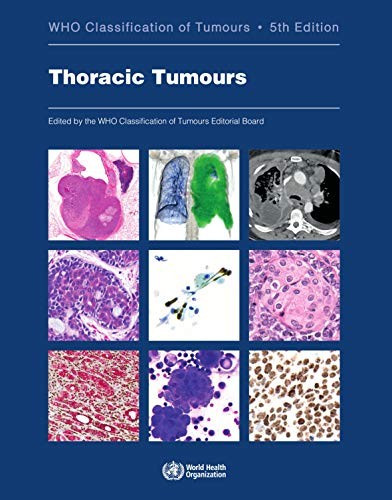 Thoracic Tumors