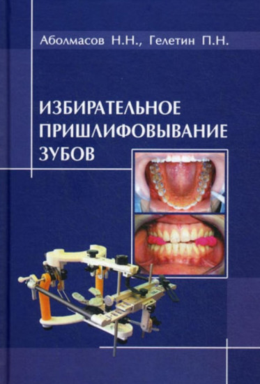 Избирательное пришлифовывание зубов