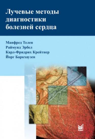 Лучевые методы диагностики болезней сердца