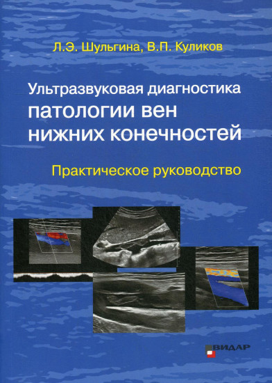 Ультразвуковая диагностика патологии вен нижних конечностей. Практическое руководство