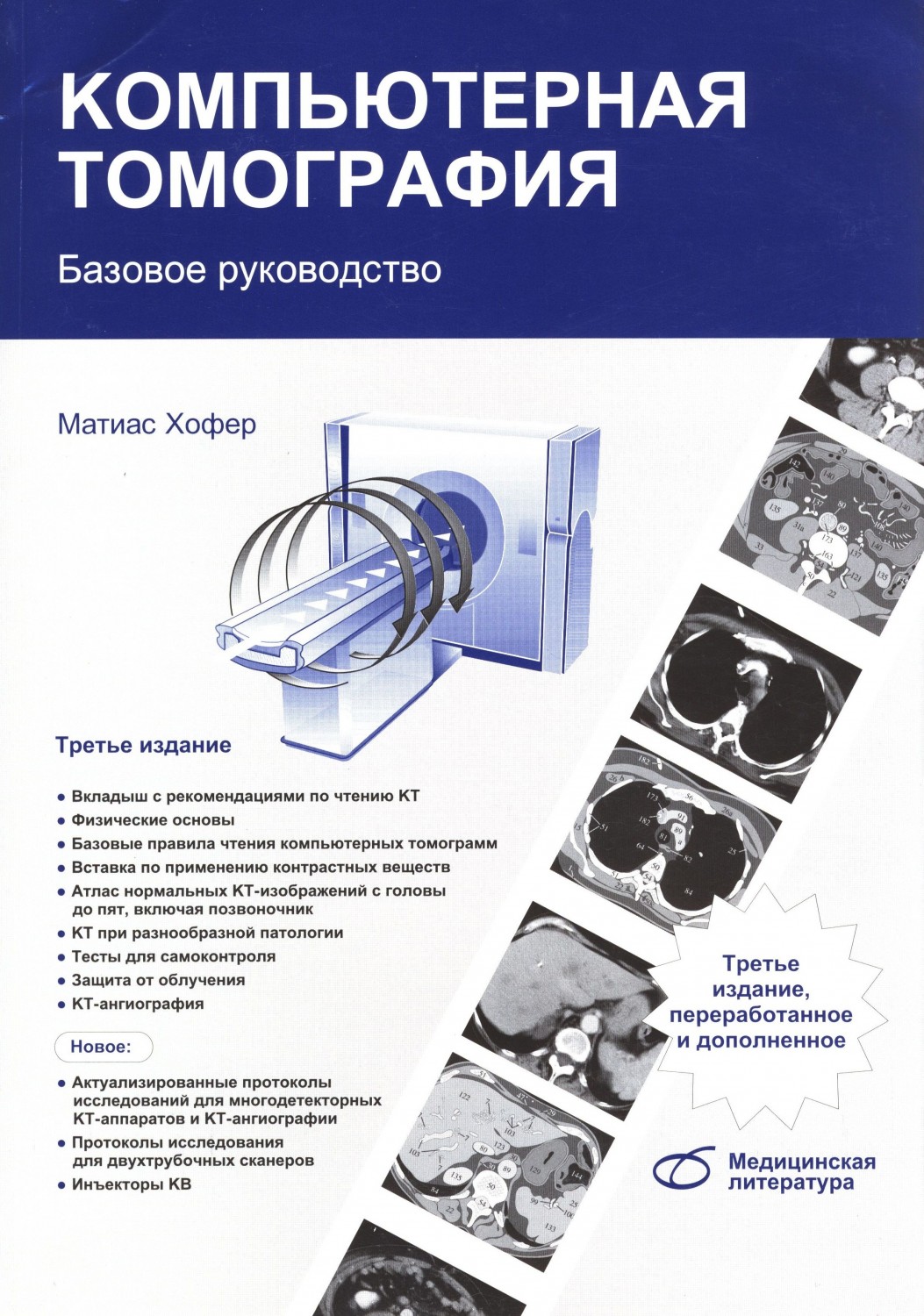 Компьютерная томография. Базовое руководство | Медицинская литература