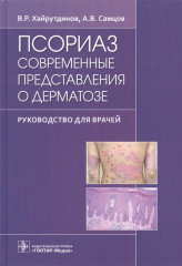 Псориаз