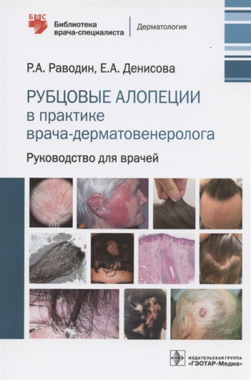 Рубцовые алопеции в практике врача