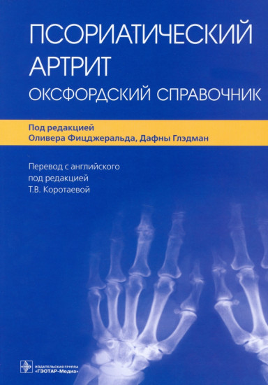 Псориатический артрит