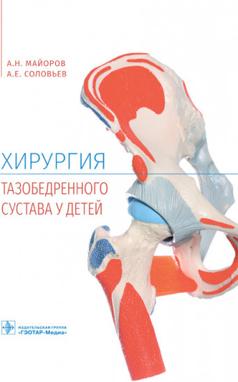 Хирургия тазобедренного сустава у детей