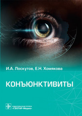 Конъюктивиты