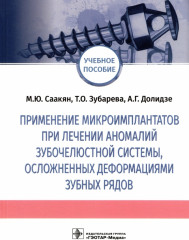 Применение микроимплантатов при лечении аномалий зубочелюстной системы, осложненных деформациями