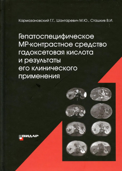 Гепатоспецифическое МР-контрастное средство