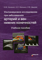 Ультразвуковое исследование при заболеваниях артерий