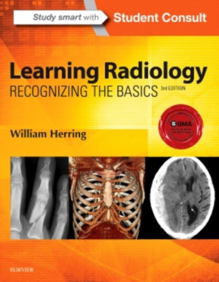Learning Radiology. Recognizing the Basics