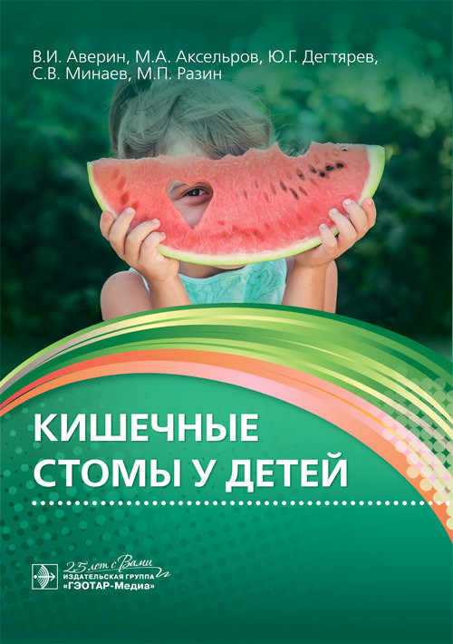 Кишечные стомы у детей. Руководство