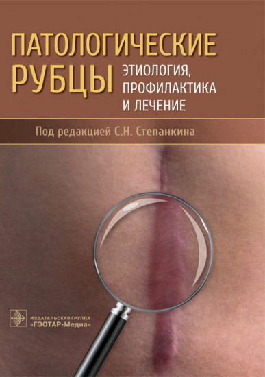 Патологические рубцы