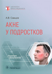 Акне у подростков. Руководство