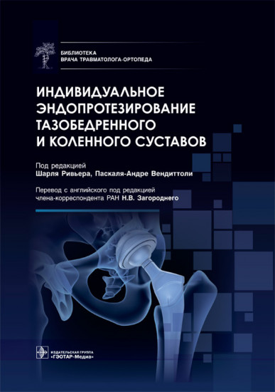Индивидуальное эндопротезирование