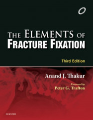 The Elements of Fracture Fixation