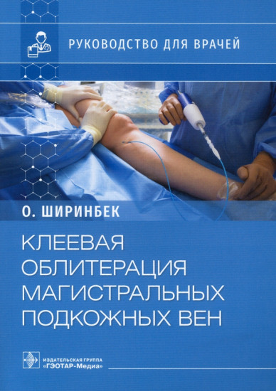 Клеевая облитерация магистральных подкожных вен
