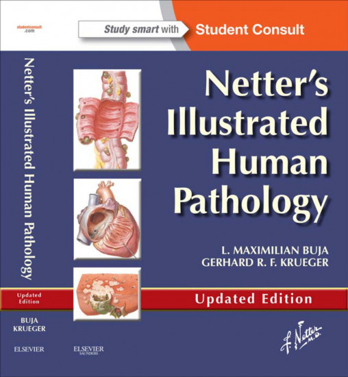 Netter`s Illustrated Human Pathology