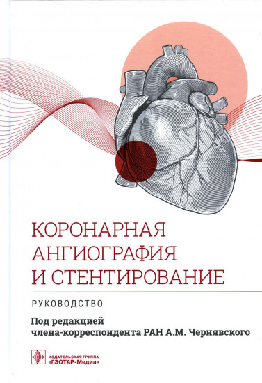 Коронарная ангиография