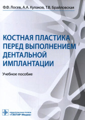 Костная пластика