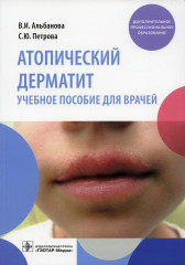 Атопический дерматит