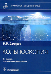 Кольпоскопия