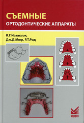 Съемные ортодонтические аппараты