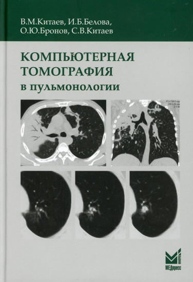 Компьютерная томография в пульмонологии