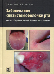 Заболевания слизистой оболочки рта