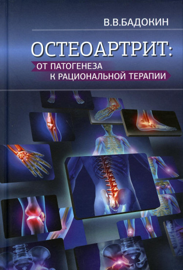 Остеоартрит. От патогенеза